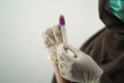 Six million euros for Oxford Immune Algorithmics Das Start-up will Bluttests normaler machen. (Foto: Shameersk/Pixabay)
